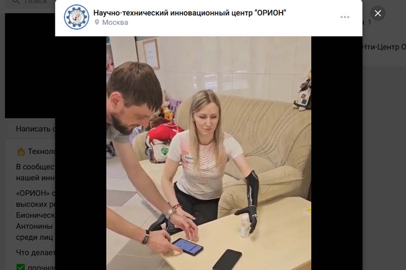 Бионический протез предплечья от «ОРИОН»: технологии для спортивных достижений